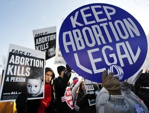 Stigmatizing abortion care
